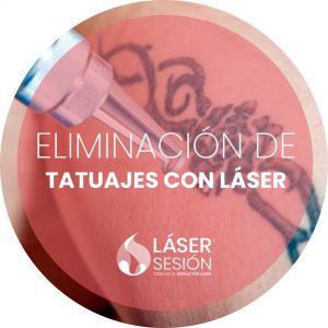 Tratamiento de eliminación de tatuajes con láser