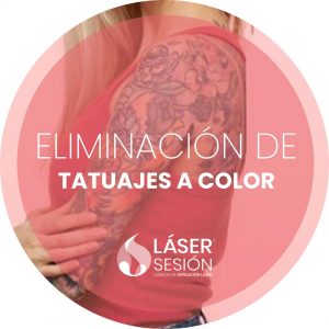 Tratamiento de eliminación de tatuajes a color